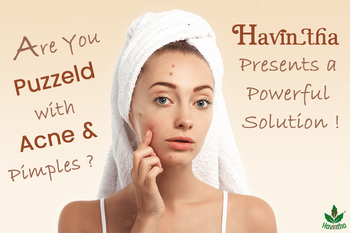 Are you puzzled with Acne And Face pimples?