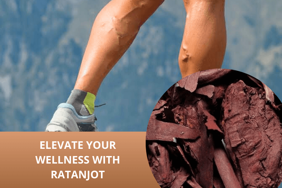 Varicose veins problem management