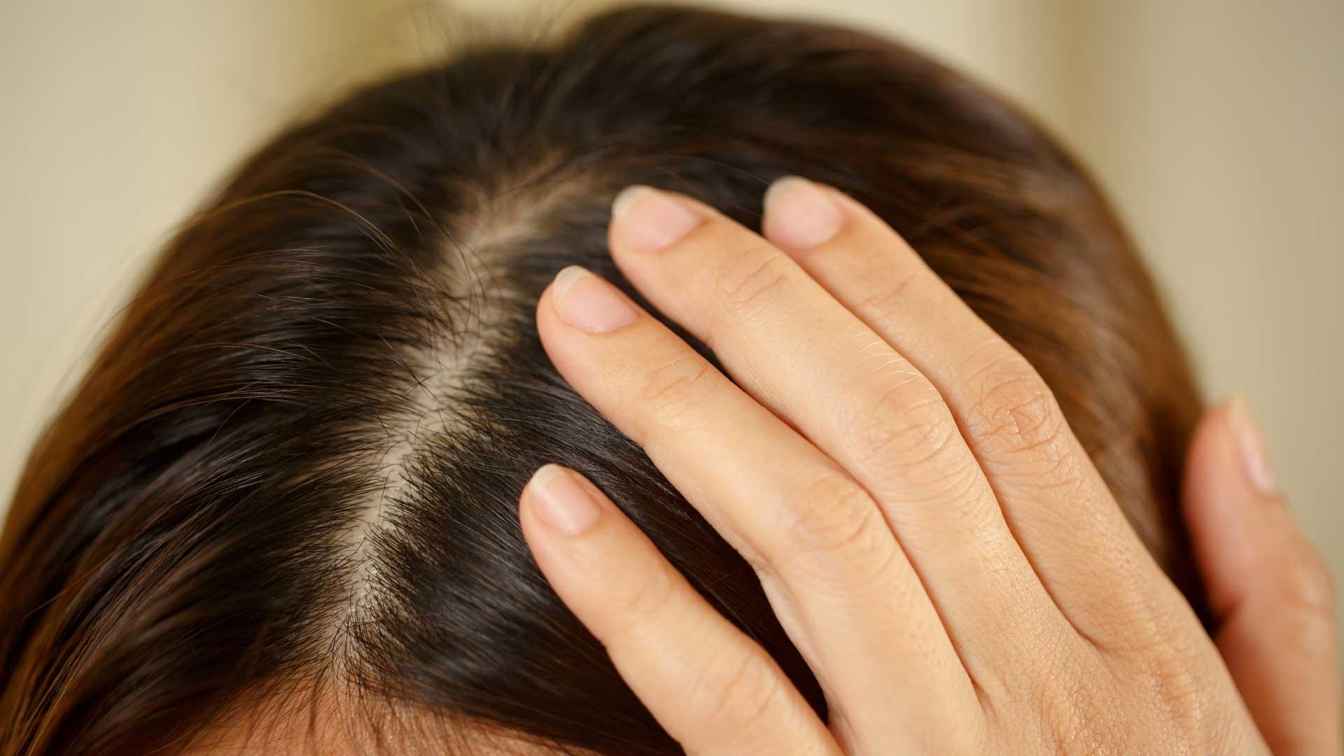Dandruff Free Hair