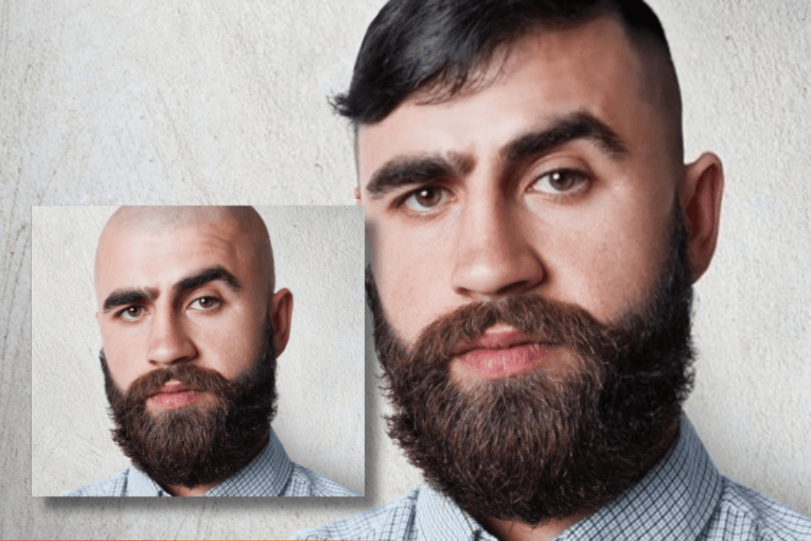 Weak, Thin and Unhealthy Hair or Strong, Thick and Healthy Hairs: Choice is yours