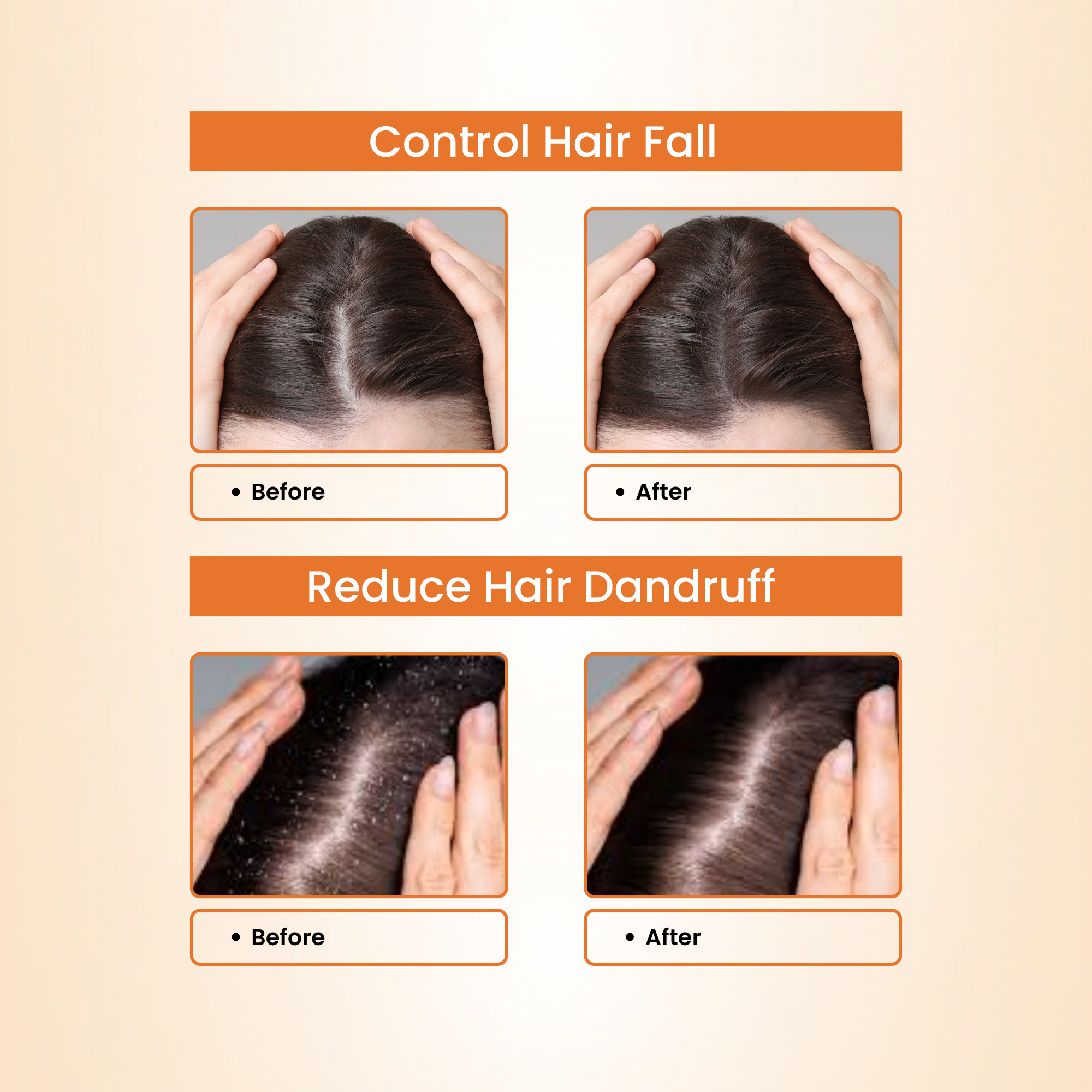 Natural Hair Shampoo with Methi Dana, Amla, Reetha & Shikakai – Fights Hair Fall & Promotes New Hair Growth |Men & Women (250g)