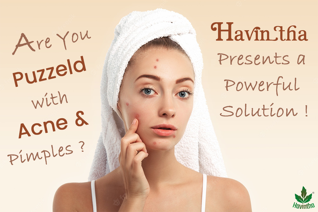 Are you puzzled with Acne And  Face pimples?