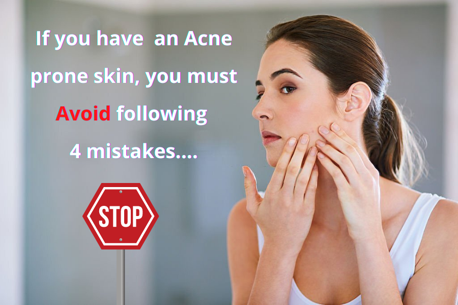 If you have an Acne prone skin ,you must avoid following 4 mistakes
