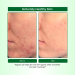 Havintha Natural Aloevera Powder for clean skin | For Glowing Skin | Natural Face Care | 250 Grams (JAR)