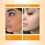 Havintha Seabuckthorn Anti-Aging Face Pack – Herbal Blend for Youthful, Glowing Skin - 100 gm for Men & Women