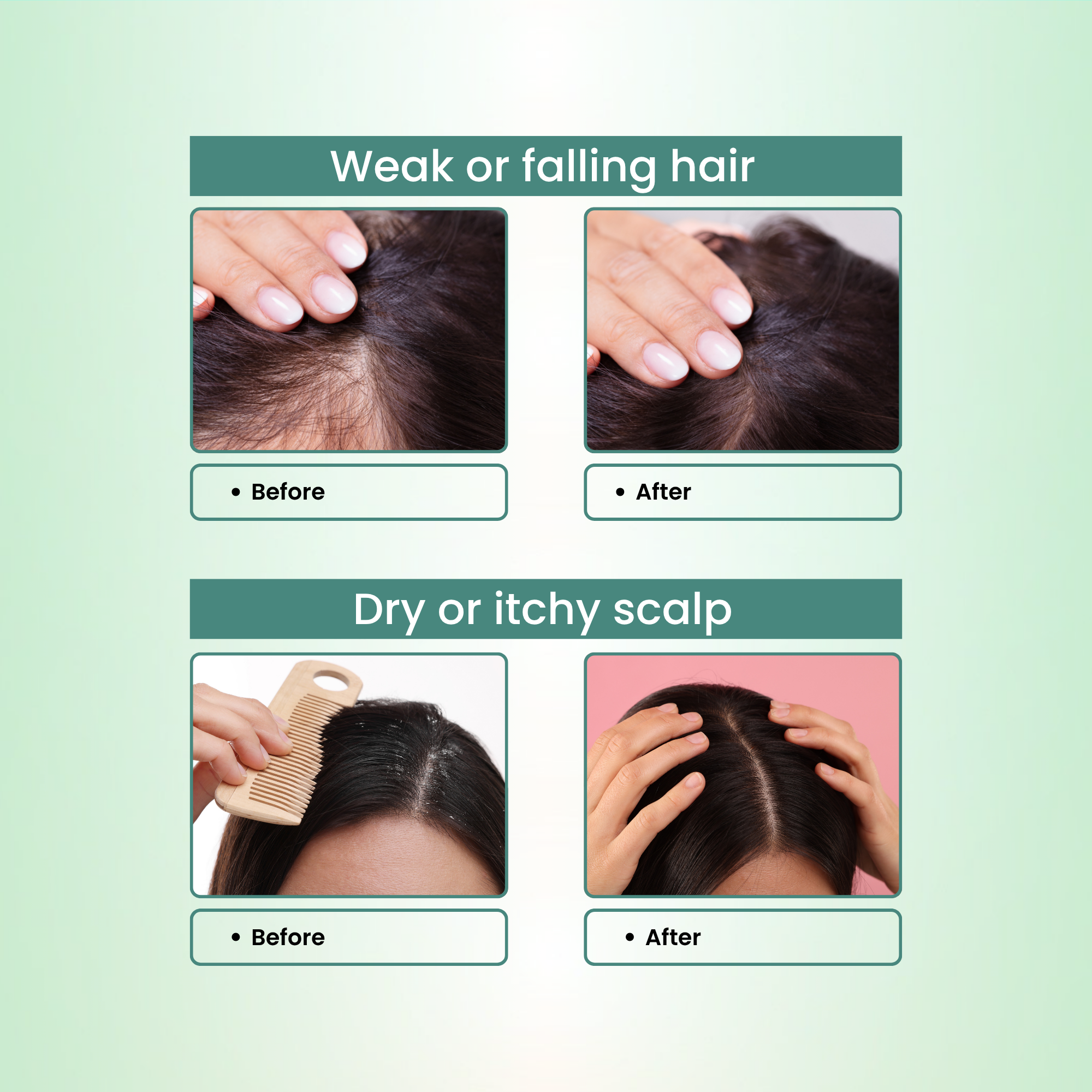 Natural Bhringraj and Brahmi Powder Shampoo | Fights Dandruff &amp; Deeply Moisturizes Hair | Men &amp; Women (227g)