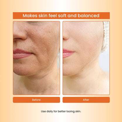 Havintha Masoor Dal Powder 100g | Natural Red Lentil Face Pack | Skin Glow &amp; Care