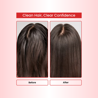 Amla Reetha Shikakai Powder Natural Hair Shampoo for Hair - 227 Grams