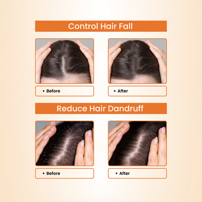 Havintha Natural Hair Shampoo 250g | Hair Fall Control | Herbal Formula with Methi, Amla, Reetha &amp; Shikakai