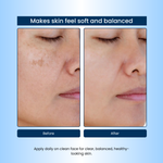 Havintha 10% Niacinamide Serum | Controls Oil, Reduces Acne Marks & Minimizes Pores | Clear & Smooth Skin Formula|30 ml