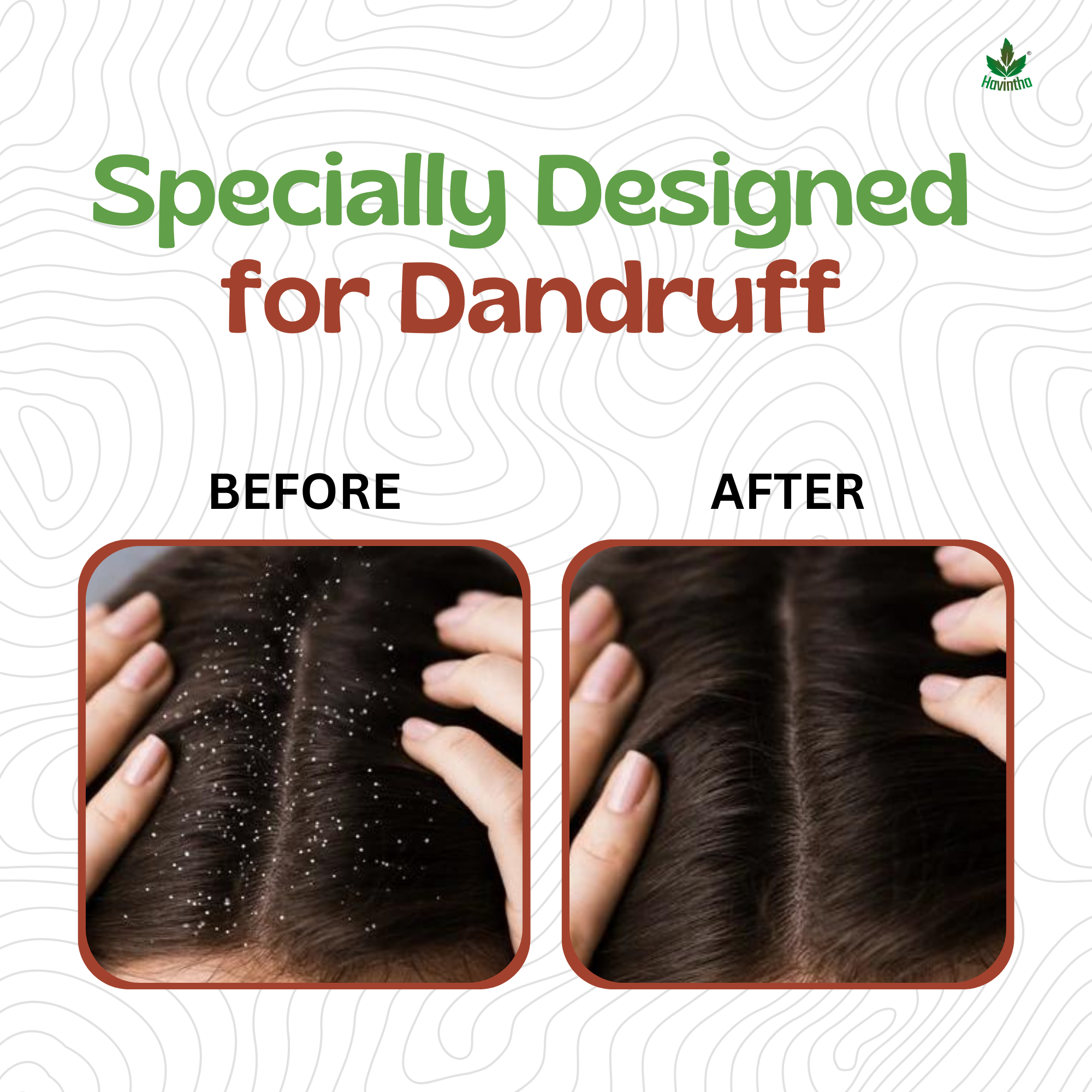 Amla Reetha Shikaki Shampoo Specially Designed for Dandruff