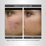 Havintha 100% Natural Activated Charcoal Powder for Skin, Face Pack, Removes Dead Skin and Natural Detoxifier for Your Body, 100 g